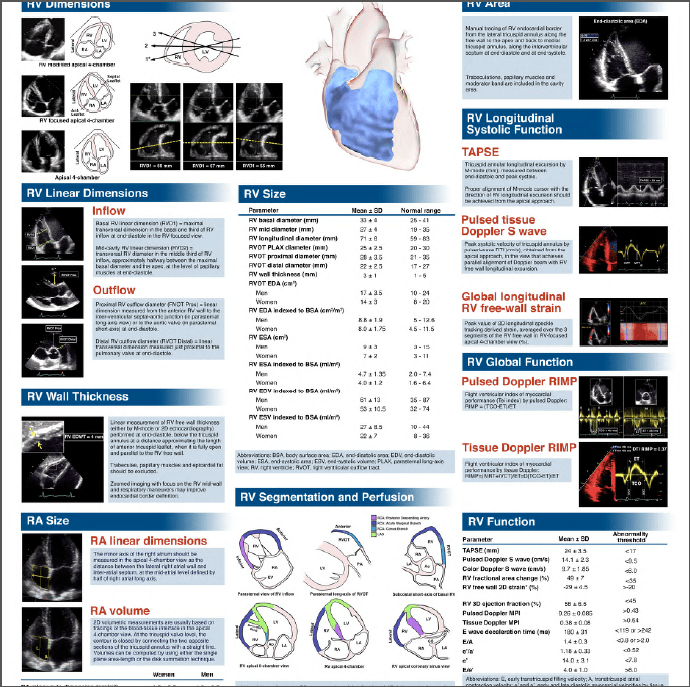 Chamber Quantification of the Right Heart Poster